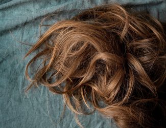 Erblich bedingter Haarausfall: Die Wechseljahre sind nicht schuld!